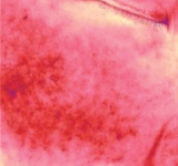 피부에 열 자극을 준 후의 상태