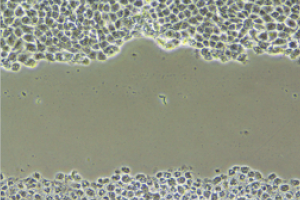 HDF 손상 회복을 통한 세포 재생력 평가 테스트