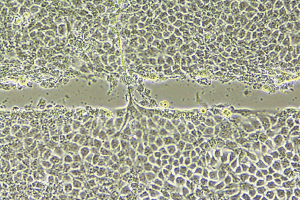 HDF 손상 회복을 통한 세포 재생력 평가 테스트