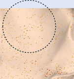 모공 개선 인체적용 시험 결과 후 이미지